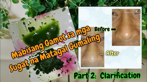 mabisang gamot sa sugat na matagal gumaling